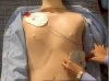 Desfibrilador Externo Automático